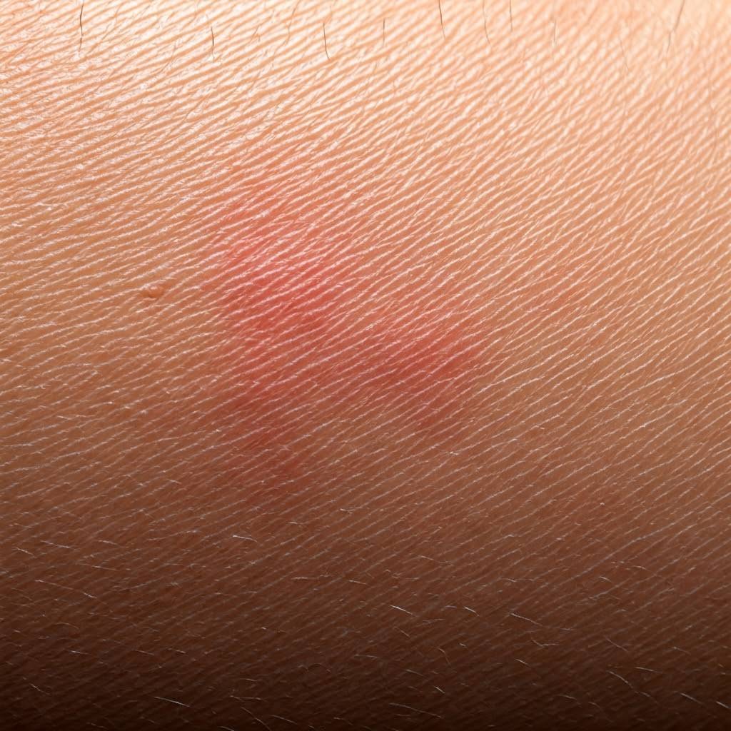 Kaşıntının Sebepleri Nelerdir?